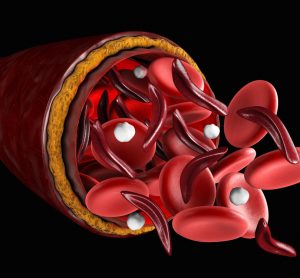 3D illustration of sickle and normal red blood cells coming out of a cut blood vessel - idea of sickle cell disease
