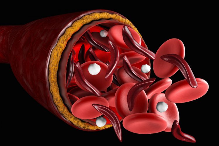 3D illustration of sickle and normal red blood cells coming out of a cut blood vessel - idea of sickle cell disease