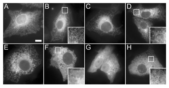 Figure 1: Diverse morphologies of the endoplasmic reticulum. (A) Antibody staining of the ER chaperone calnexin in Vero cells showing a typical reticular distribution throughout the entire cell. (B-H) GFP-tagged open reading frames expressed in Vero cells for 24 hours and then imaged in the living cells. All of the expressed proteins localise to ER membranes, however the morphology of this organelle appears very different depending on the protein expressed. The proteins in panels B-D show a predominantly reticular pattern, although in panel D a number of distinct punctate structures can also be seen. The proteins in panels E and F show a more sheet-like appearance. The protein in panel G also displays a significant amount of soluble cytoplasmic signal, and the protein in panel H causes a abnormal vesiculation of the ER.