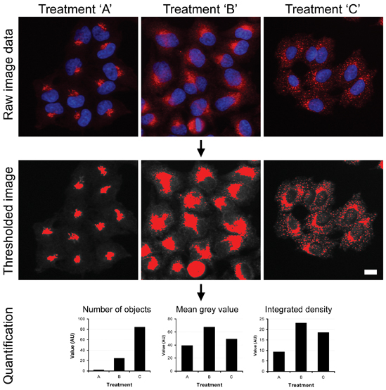 Figure 2: High content analysis of complex subcellular structures. HeLa cells were fixed and then immunostained with antibodies against the Golgi marker GM130 (red channel in upper panel) following treatment with control buffer (treatment A) or two different chemical reagents known to perturb Golgi morphology (treatments B and C). The images were then background-subtracted and then thresholded to identify structures of interest. Multi-parameter analysis was then carried out on these structures on a cell-by-cell basis using ImageJ software.