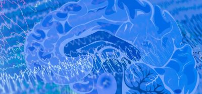 New collaboration could advance small molecule epilepsy PRAX-020 therapy