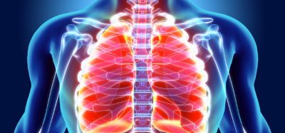 AstraZeneca small molecule treatment reduces risk of death by half in NSCLC