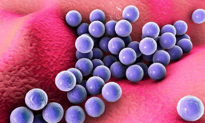 Staphylococcus aureus