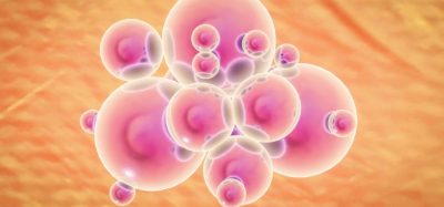 Lonza and Vertex to partner to manufacture diabetes cell therapies