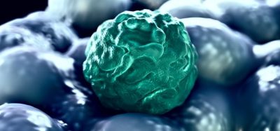 First mixed race woman potentially cured of HIV from stem cells from cord blood