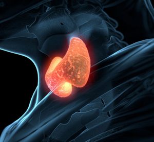 FDA approves new uses for two drugs administered together for treatment of BRAF-positive anaplastic thyroid cancer