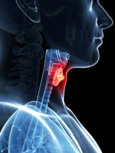 thyroid cancer