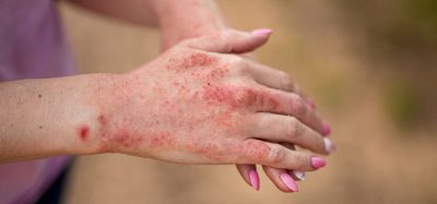 MHRA authorises novel pre-filled pen injector tralokinumab