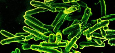 Temperature-stable tuberculosis vaccine induces immune response