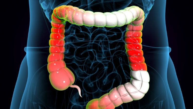 Takeda ulcerative colitis biologic receives FDA approval