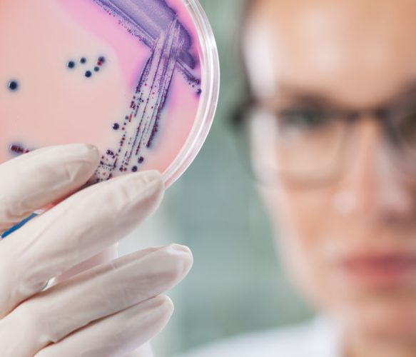 woman assessing microbiology petri dish